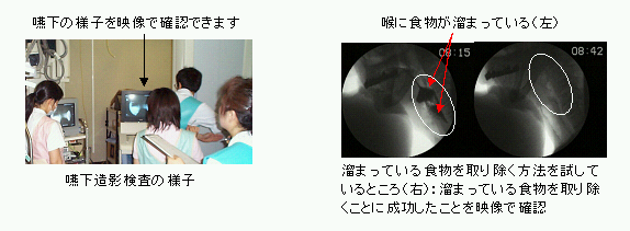嚥下
